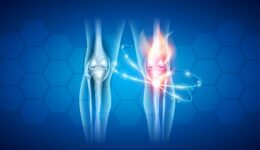 joint replacement center orthopedics conway