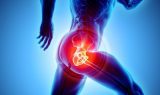 hip replacement specialists conway sc
